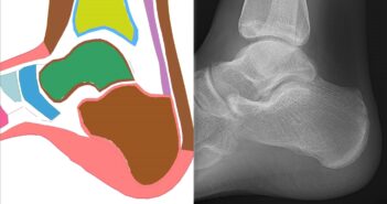 Toyota Collaborative Safety Research Center announces four new projects CSRC is assessing, for example, why crash injury differences have been reported between males and females, particularly in the ankle