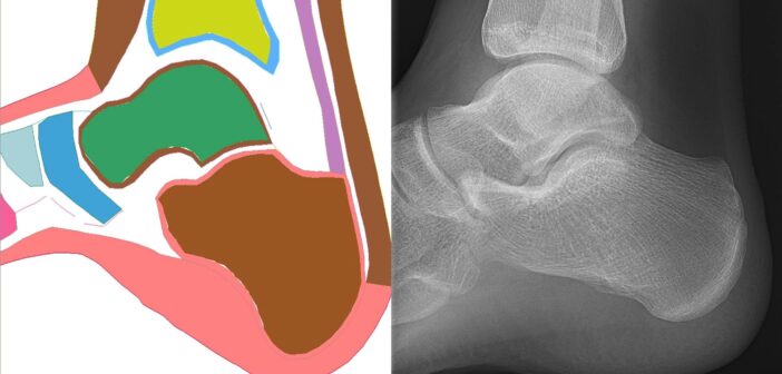 CSRC is assessing, for example, why crash injury differences have been reported between males and females, particularly in the ankle