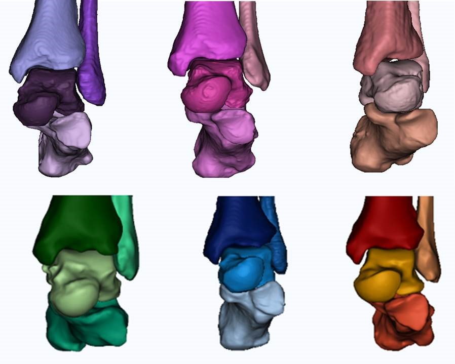 Research will use a combination of computer modeling with the THUMS, tissue experiments and medical imaging data to investigate ankle injury mechanisms and differences across population groups, especially biological sex